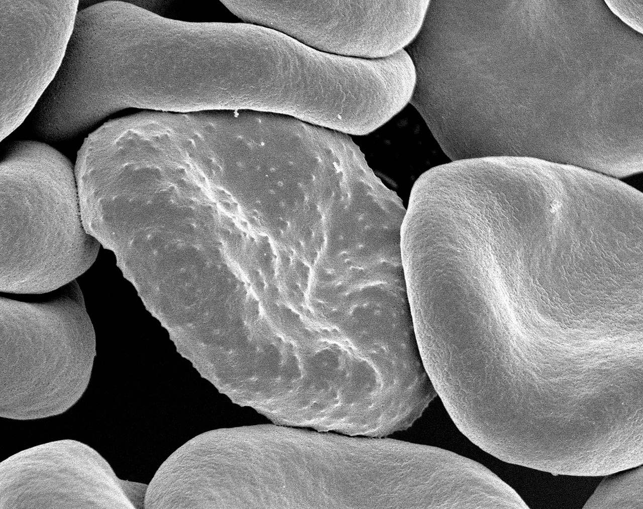 WHO Umumkan Vaksin Malaria Generasi Ketiga dengan Efektivitas 85 Persen